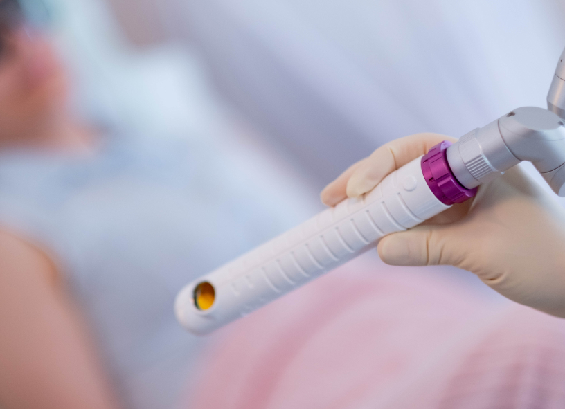 Intimgesundheit – CO₂-Laser Basel